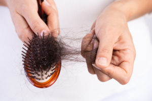 Queda de cabelo
